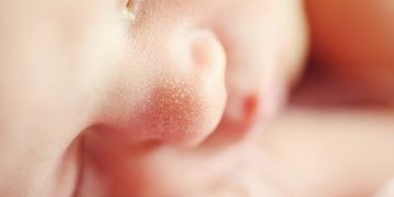 A soothing baby experiencing discomfort from teething with natural remedies nearby.