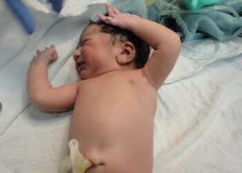 Mastering the Art of Diaper Changing: Expert Tips for Stress-Free Changes