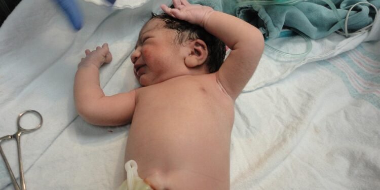 Mastering the Art of Diaper Changing: Expert Tips for Stress-Free Changes