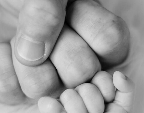 Shining a Light on Newborn Jaundice: Recognizing the Signs and Symptoms